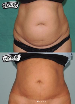 Slider image (3) Orange Tree Aesthetic And Hair Restoration Centre